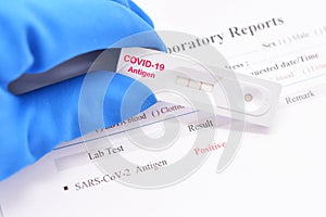 COVID-19 positive by antigen rapid test