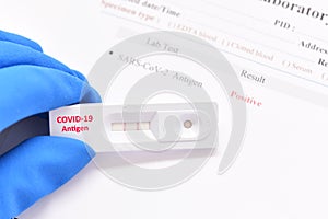 COVID-19 positive test result by using antigen test kit