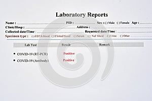 COVID-19 positive test results