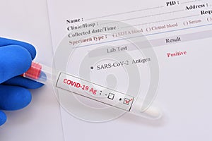 COVID-19 positive by using antigen test kit