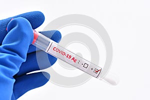 COVID-19 positive by using antigen test kit