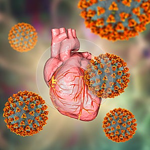 COVID-19 viruses affecting the heart, conceptual 3D illustration