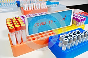 Covid-19. An infected Covid-19 sample in a test tube with a label in the doctor`s hand. Laboratory tube with SARS-CoV2. Laborator