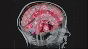 Covid 19 brain x ray CT scan and MRI concept illastration 3d.