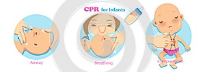 Cpr Infant