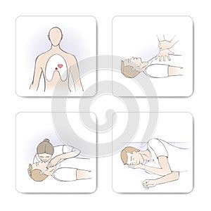 CPR procedure