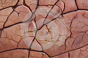 Cracked human skin, macro view