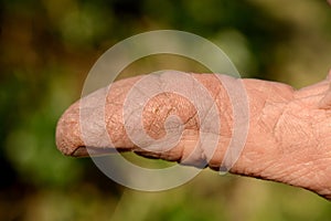 Cracked skin on a workman's hand