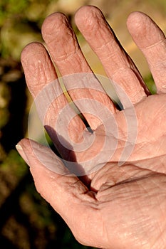 Cracked skin on a workman's hand