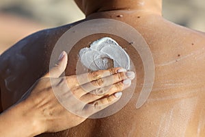 Creaming the back of a boy on the beach