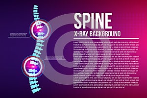 Creative vector illustration of spine x-ray, pain neck, disk degradation, injury treatment on background. Art design