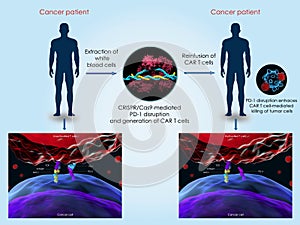 CRISPR-Cas9 system to treat cancer