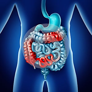 Crohn Disease And Digestion illness photo