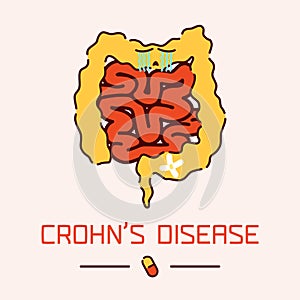 Crohn's disease poster photo