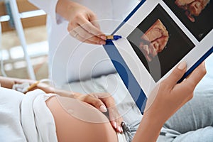 Cropped of doctor showing ultrasound photo to pregnant woman of her future baby