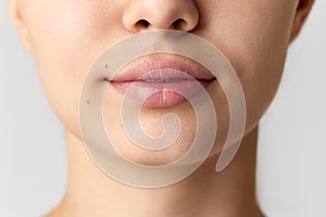 Cropped image of female face, nose, lips and chin. Plastic surgery, fillers, lip augmentation