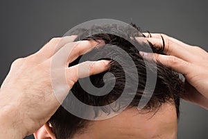 Cropped Image Of Man Suffering From Dandruff