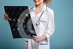 Cropped image of smiling female doctor holding roentgenogram