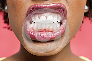Cropped image of woman clenching teeth photo