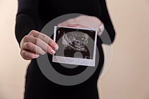 Cropped image of young pregnant woman holding ultrasound picture on belly. Concept of pregnancy, health care, gynecology, medicine