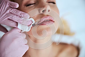 Female patient undergoing the lip enhancement procedure photo