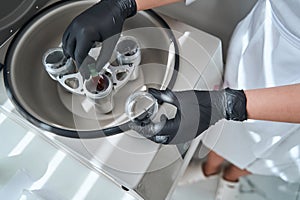 Certified dermatologist preparing a platelet-rich plasma for an anti-aging serum photo