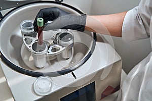 Experienced doctor preparing a platelet-rich plasma for anti-aging therapy photo