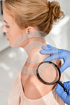 Cropped view of dermatologist examining skin