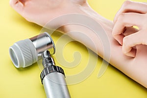 Cropped view of woman itching hand near dermatoscope on yellow.