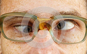 Cross-eyed person in old-fashioned spectacles photo