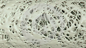 Cross section of an advanced osteoporosis - 3d rendering