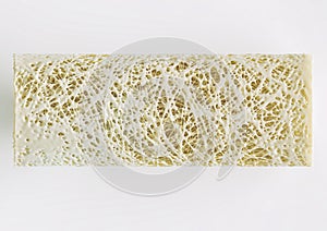 Cross section of an advanced osteoporosis -high details - Stage 4 - 3d rendering