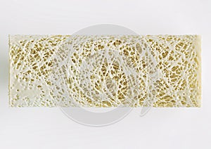 Cross section of an advanced osteoporosis -high details - Stage 4 - 3d rendering photo