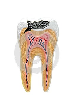 Cross section of a anatomical tooth model