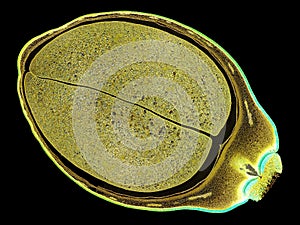 Cross section cut slice of plant stem under the microscope â€“ microscopic view of plant cells for botanic education