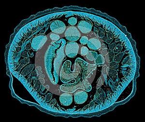 Cross section cut under the microscope â€“ microscopic view of animal cells for education