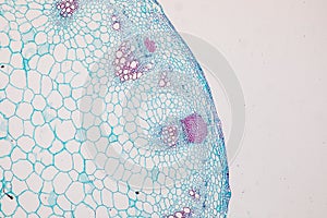 Cross-section Dicot, Monocot and Root of Plant Stem under the microscope.