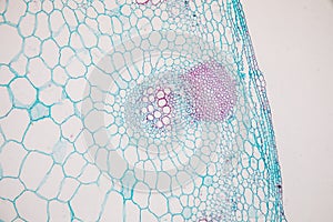 Cross-section Dicot, Monocot and Root of Plant Stem under the microscope.