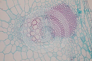 Cross-section Dicot, Monocot and Root of Plant Stem under the microscope.