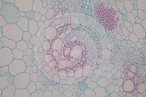 Cross-section Dicot, Monocot and Root of Plant Stem under the microscope.