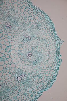 Cross-section Dicot, Monocot and Root of Plant Stem under the microscope.