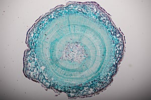 Cross-section Dicot, Monocot and Root of Plant Stem under the microscope.