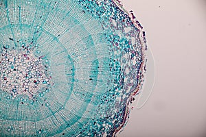 Cross-section Dicot, Monocot and Root of Plant Stem under the microscope.