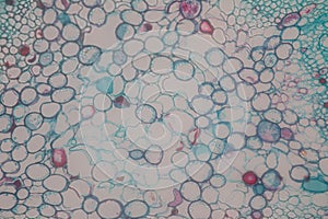 Cross-section Dicot, Monocot and Root of Plant Stem under the microscope.