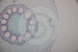 Cross-section Dicot, Monocot and Root of Plant Stem under the microscope.