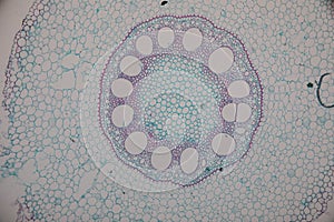 Cross-section Dicot, Monocot and Root of Plant Stem under the microscope.