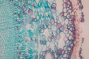 Cross-section Dicot, Monocot and Root of Plant Stem under the microscope.