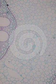 Cross-section Dicot, Monocot and Root of Plant Stem under the microscope.