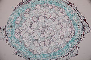 Cross-section Dicot, Monocot and Root of Plant Stem under the microscope.