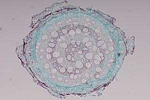 Cross-section Dicot, Monocot and Root of Plant Stem under the microscope.